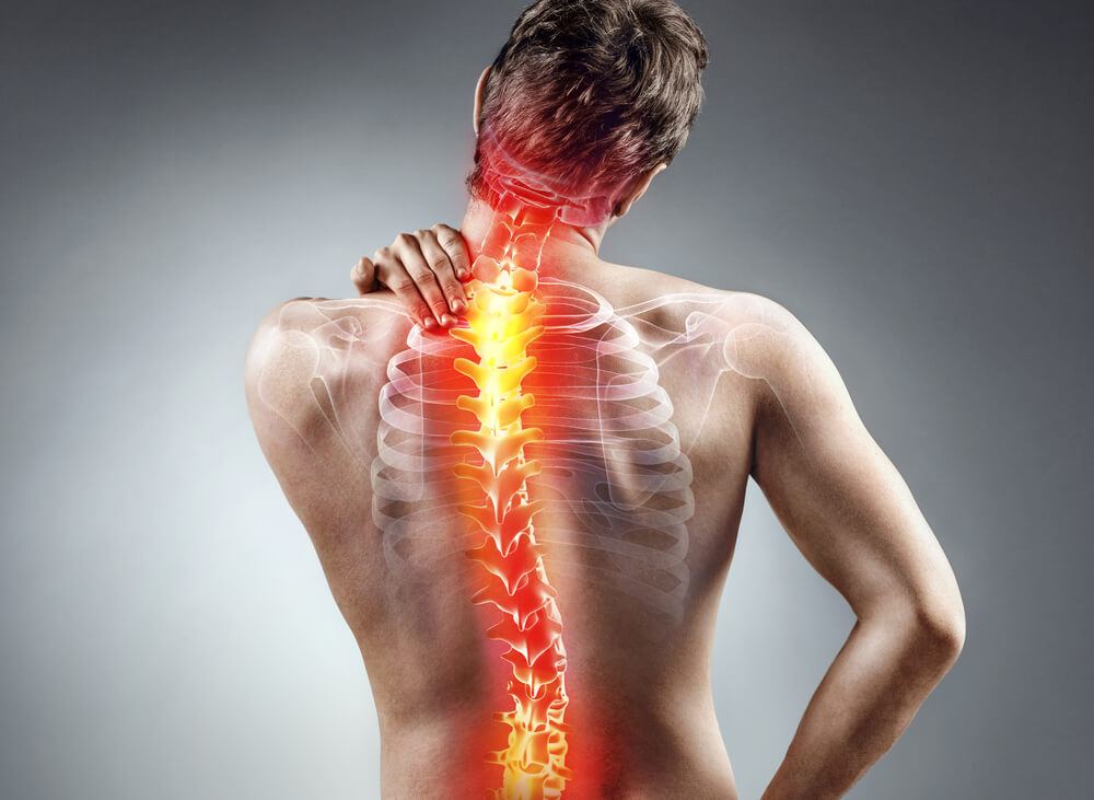 Spinal Cord Injury